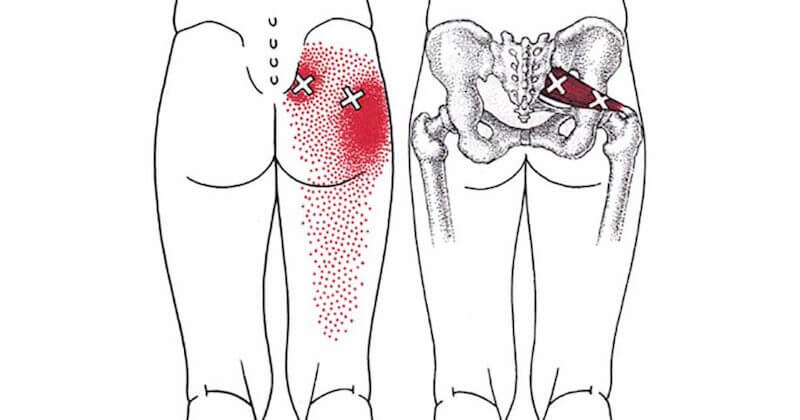 How To Get A Deep Piriformis Stretch To Get Rid of Sciatica, Hip & Lower Back Pain