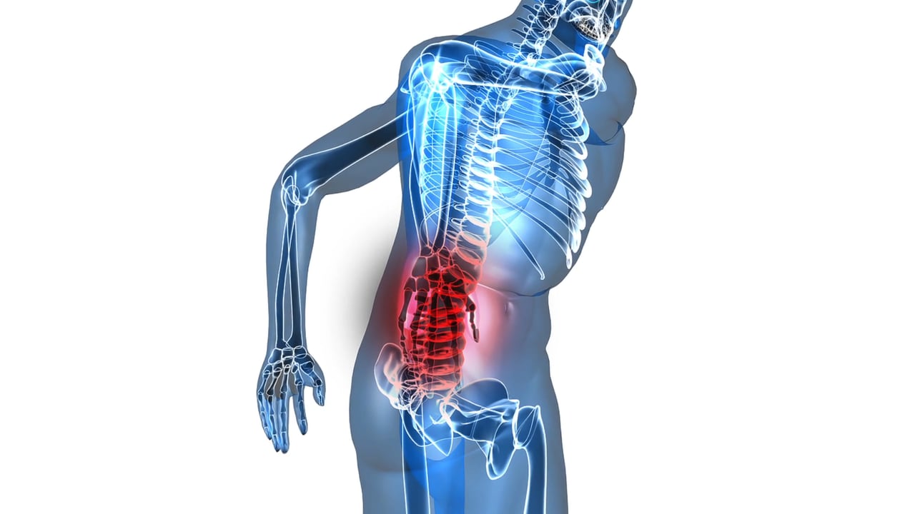 Back Pain Linked to Knee Pain