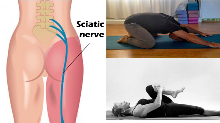 11 Easy Exercises to Relieve Sciatic Nerve Pain in 15 Minutes (with videos) – The Health Science Journal