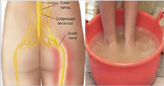 Say goodbye to sciatic nerve pain in just 10 minutes with this natural method!