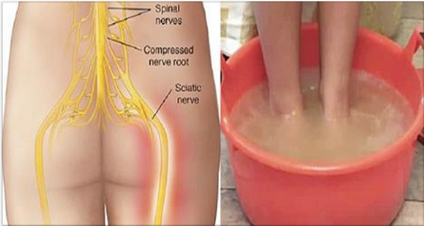 SAY GOODBYE TO SCIATIC NERVE PAIN IN JUST 10 MINUTES WITH THIS NATURAL METHOD! – Good Medical Tips