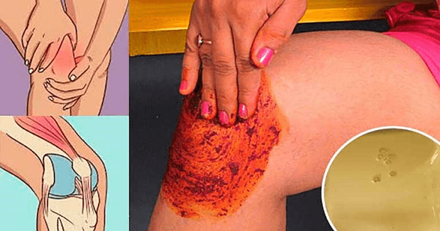 People Go Crazy For This Recipe! It Heals Joint Pain, Knee and Bone – Living Wellmindness