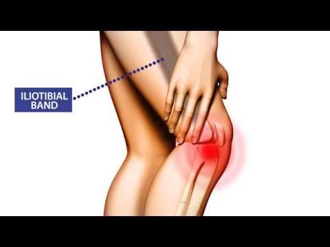 Knee Pain: Symptoms, Treatment, and Prevention