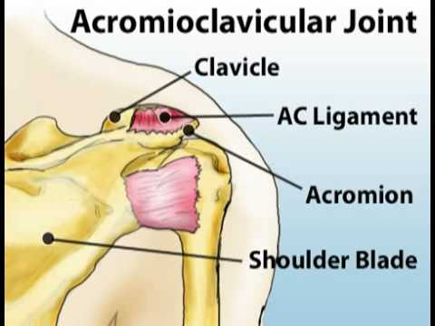 Understanding Shoulder Pain (Sports Injuries #3)