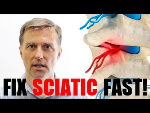 Fix SCIATIC Pain Fast – MUST WATCH!