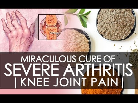 Easiest & Cheapest Way To Cure Severe Arthritis & Joint Pain – By Rajiv Dixit