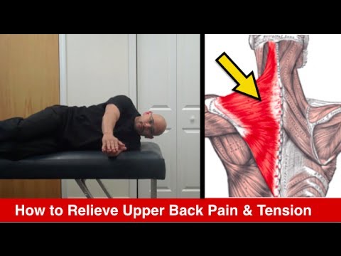 Atlanta Chiropractor – How to Relieve Upper Back Pain – Personal Injury Doctor Atlanta