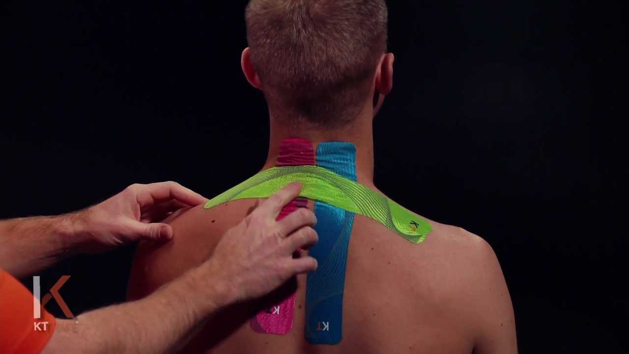 KT Tape: Neck and Shoulder
