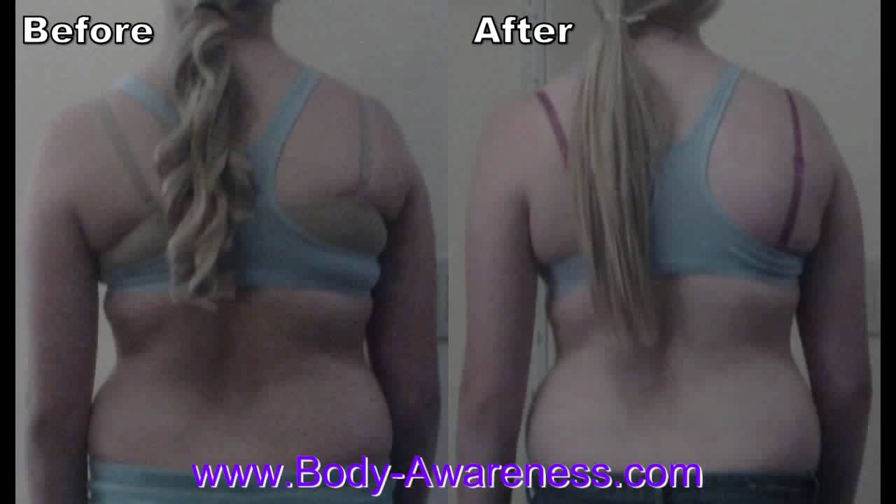 Scoliosis treatment no pain, Taller and straighter in minutes, alternative therapy pain relief