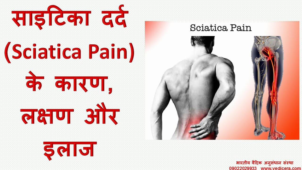 साइटिका दर्द  के कारण, लक्षण और इलाज : Sciatica Pain Causes, Symptoms and Treatment