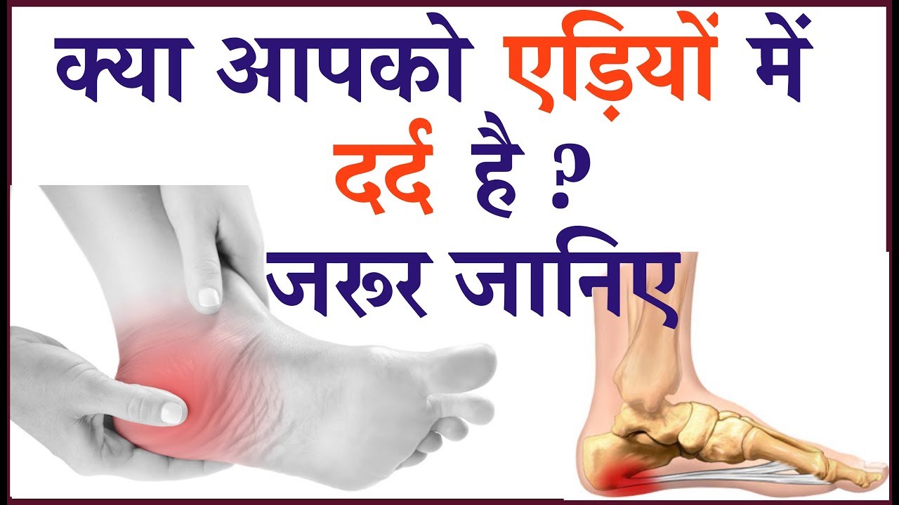 क्या आपको एड़ियों में दर्द है जरूर जानिए ? | Heel Pain Cure Treatment | Heel Pain Relief