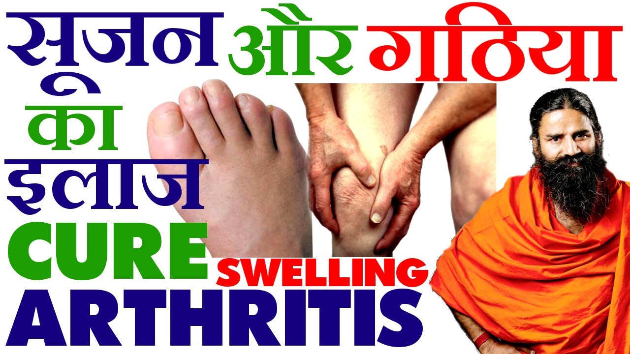 Arthritis Treatment | Cure Swelling – gathiya aur soojan ke ilaj ka tarika by Ramdev Yoga Remedies
