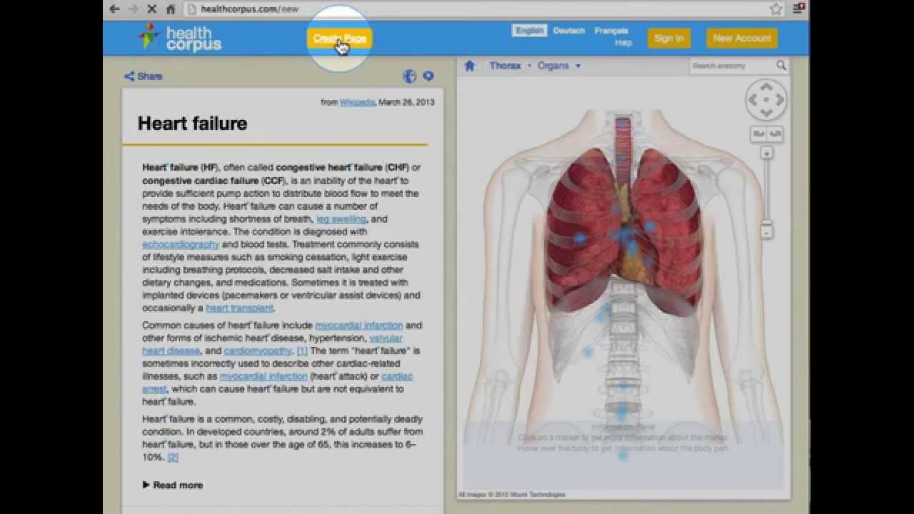 HealthCorpus – Use a Virtual Body to Search and Browse Health Articles