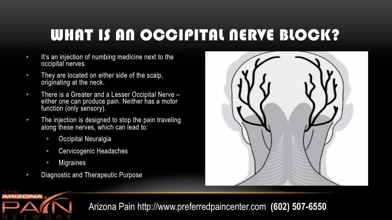 Info on Occipital Nerve Block Procedure from an AZ pain center (602) 507-6550