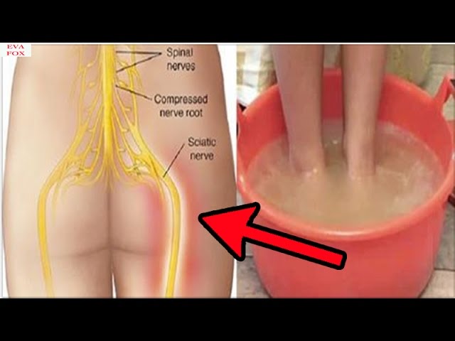 He said goodbye to sciatic nerve pain in 2 days thanks to this natural remedy from India