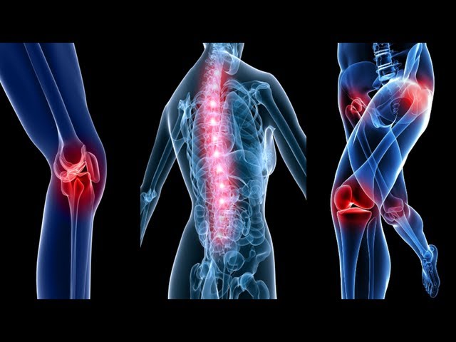 Miraculous Treatment of Arthritis Knee Joint Pain Fever Pain – Rajiv Dixit