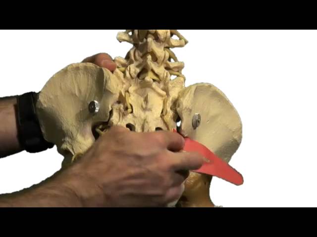 Sciatic Nerve Pain Relief