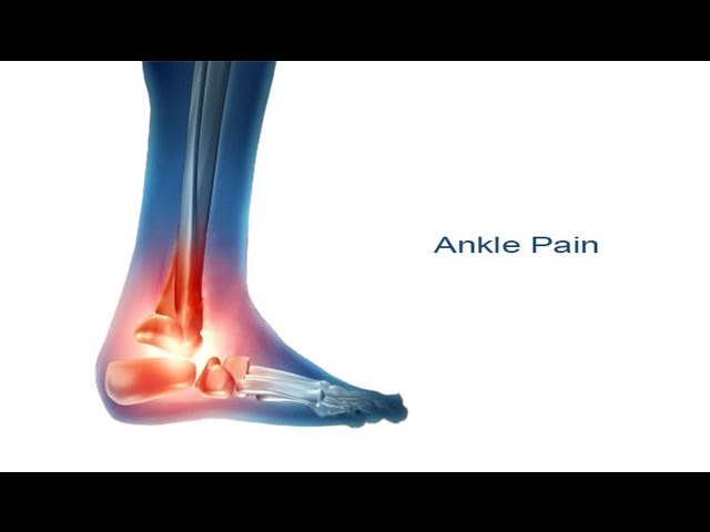 5 Steps to Ankle Pain Relief