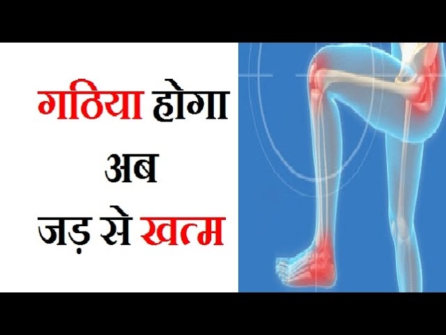देखें पुरानी से पुरानी गठिया का इलाज ।। Arthritis Treatment in Ayurveda || गठिया का घरेलू उपाय